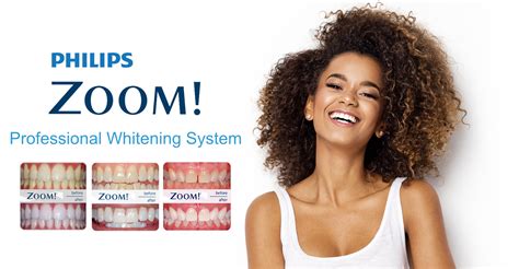 teeth whitening lodi|Philips Zoom! .